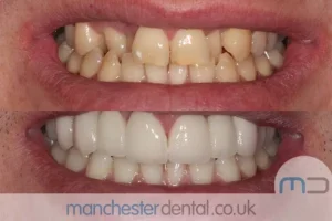 Teeth-Whitening-with-URL_0001_Whitening work gallery (1) Teeth-Whitening-with-URL_0001_Whitening work gallery (1)