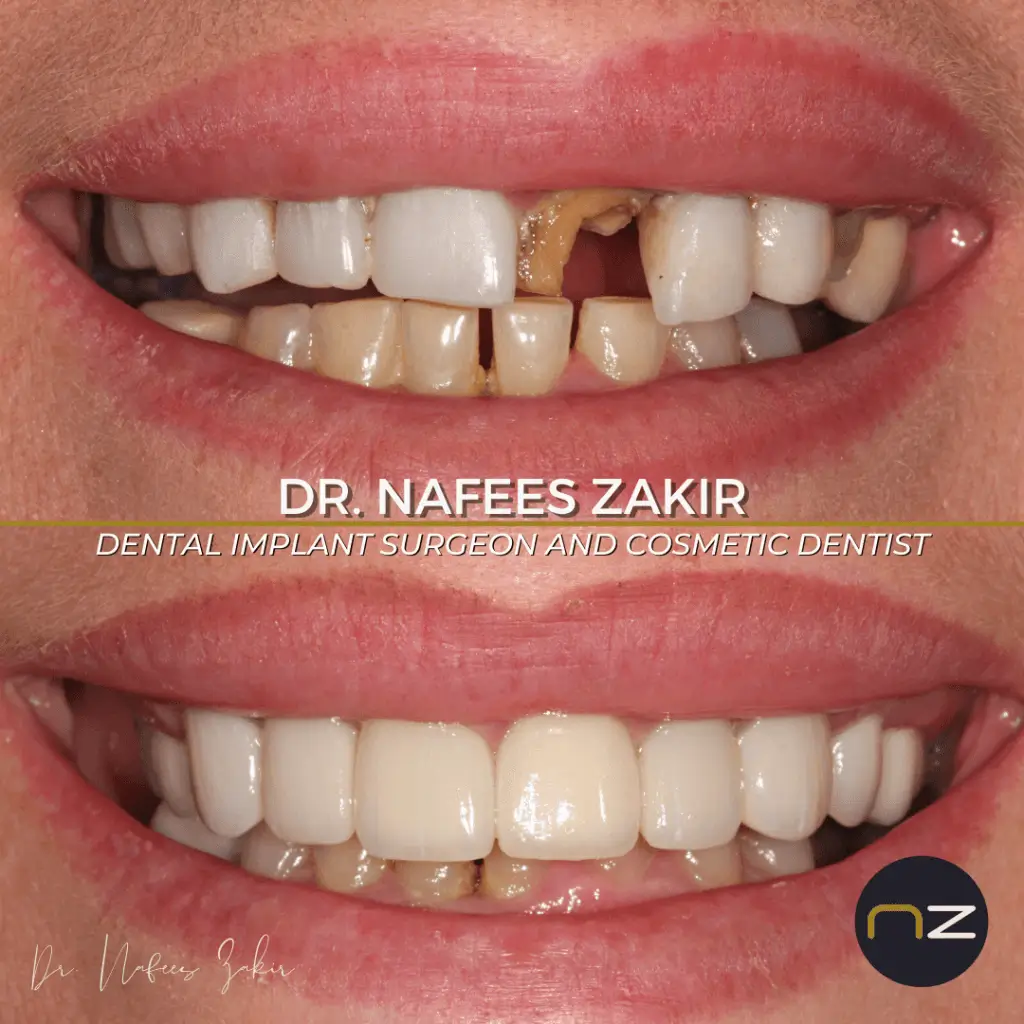 manchesterdental-home-gallery-10 manchesterdental-home-gallery-10