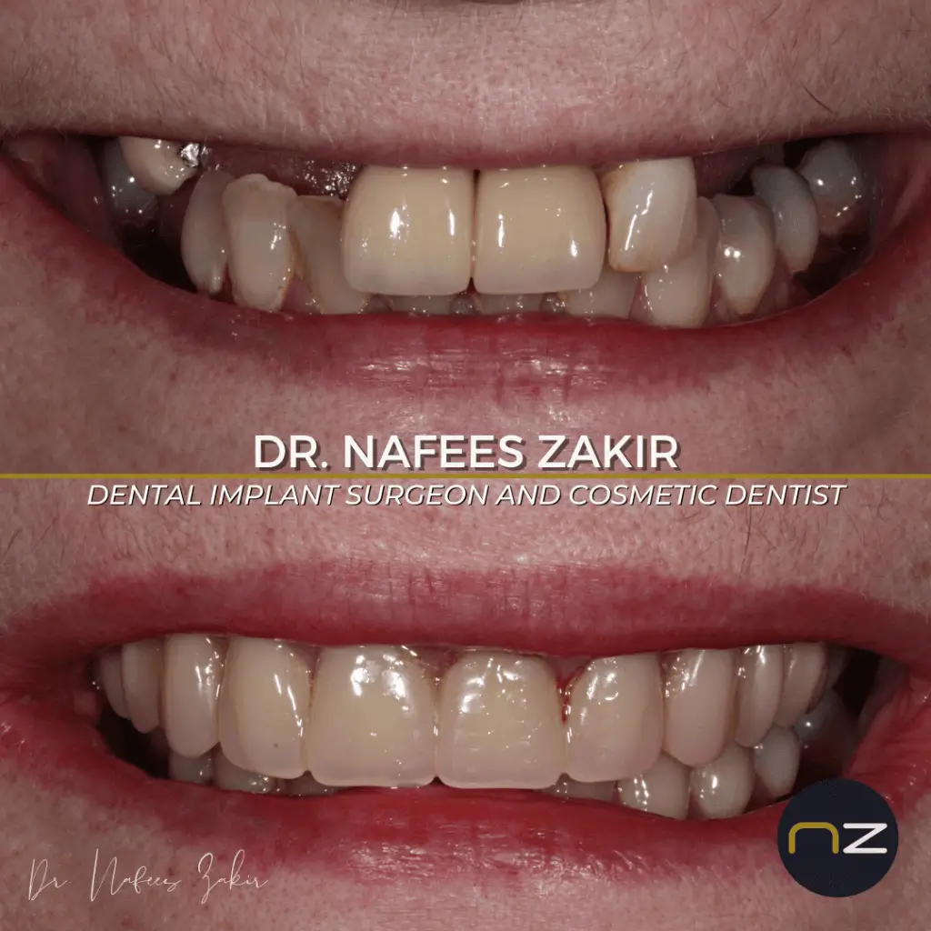 manchesterdental-home-gallery-11 manchesterdental-home-gallery-11